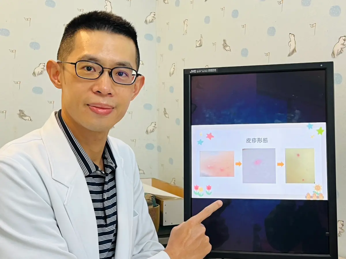 ▲有個案雖然打過一劑水痘疫苗，但仍長水痘，醫師提醒，兒童施打一劑水痘疫苗的保護力大約86%。（圖／書田診所提供）