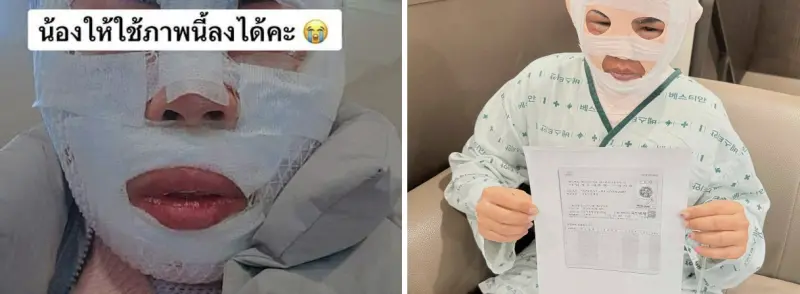 ▲一名泰國女子遭韓籍丈夫以滾水潑臉重傷，整張臉被迫以繃帶包裹。（圖／翻攝自臉書）