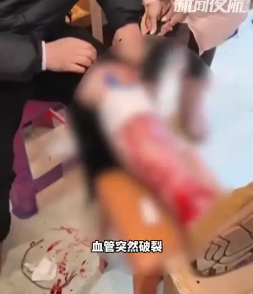 零下20℃只穿薄褲！男遊東北「血管凍裂」噴滿地　落地成血冰
