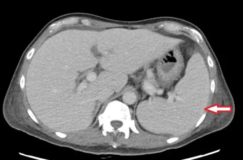 ▲醫師提醒，民眾若出現長期不明原因水腫、疲倦、反覆發燒等症狀，應積極就醫評估是否有心臟疾病的問題，排除感染可能。（圖／台北慈濟醫院提供）