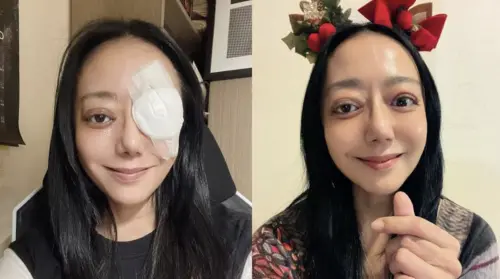 高慧君眼珠翻出恐失明！罕見公開大小眼正面照　嘆剩最後一次手術
