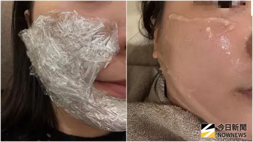 ▲陳小姐分享，自己前往韓國進行醫美的經驗非常不錯，也願意再次到韓進行。（圖／陳小姐提供）