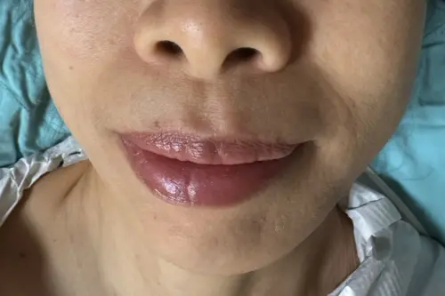 ▲醫師提醒，民眾一旦發現兩頰出現不明腫塊，建議盡早至耳鼻喉科就診，尋求專業醫師診斷。（圖／台北慈濟醫院提供）