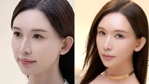 ▲林志玲最新廣告中的樣貌（左右圖）被網友說長得不太一樣。（圖／皮膚科段鱈芸醫生、林志玲工作室微博）
