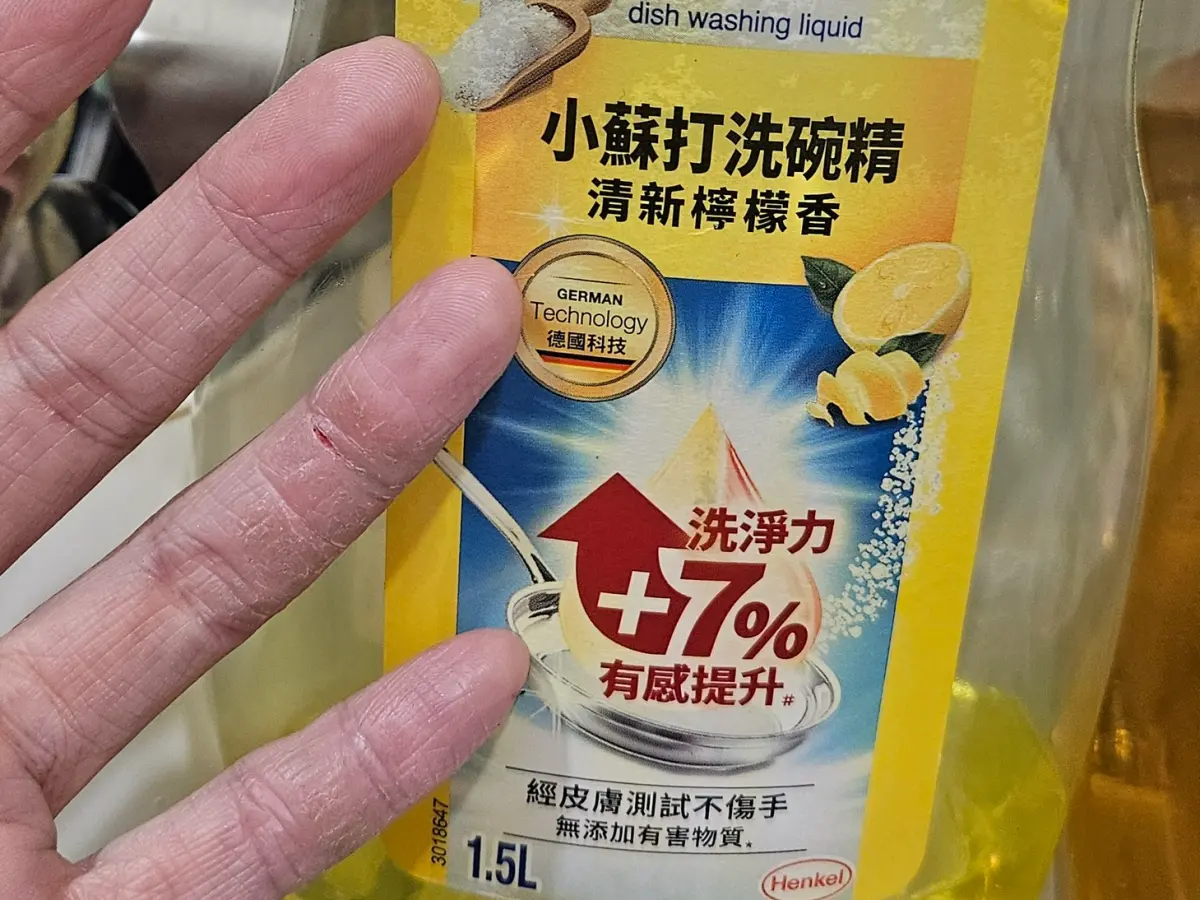 ▲有網友分享使用該款熱門洗碗精後，手部竟出現乾裂情形，引發社團熱烈討論。（圖／翻攝自臉書社團「我愛全聯-好物老實說」）