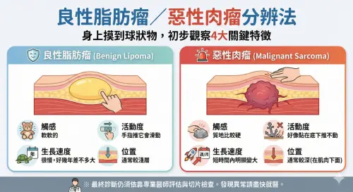 ▲良性脂肪瘤和惡性肉瘤分辨方法，要觀察觸感、活動度、生長速度和位置等4關鍵。有任何疑慮都應及時就醫，以免影響治療。（圖／AI 生成）
