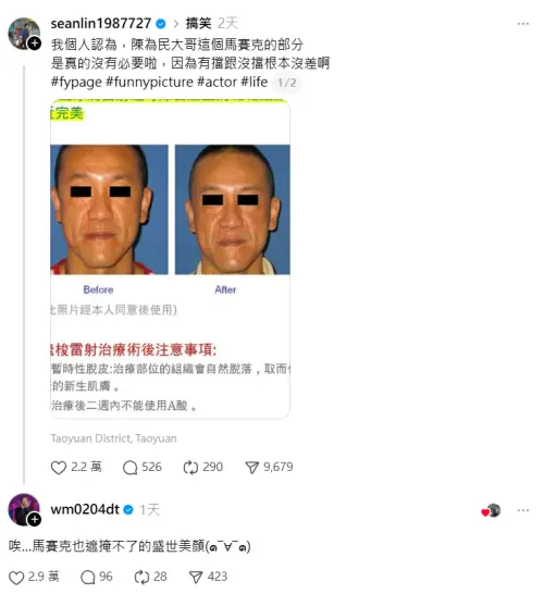 ▲陳為民被林家祥曝光醫美對比照，直接釣出本人幽默回應。（圖／林家祥Threads@seanlin1987727）