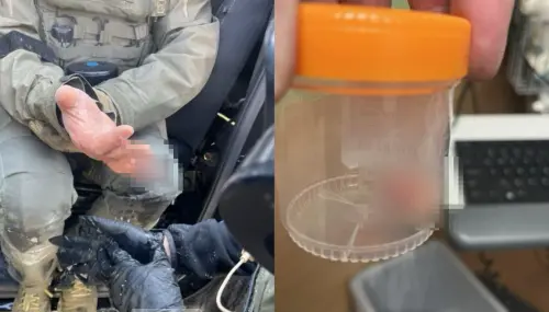 ▲美國總統川普在自家社群轉發一張ICE探員手指被咬斷的照片，畫面相當驚悚。（圖／翻攝自Truth Social）