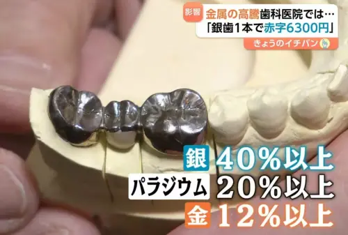 國際貴金屬飆漲、牙醫診所竟遭殃！日媒：做一顆銀牙賠6300日圓
