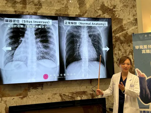 ▲台中一名33歲上班族，高中時健康檢查發現自己患有發生率僅萬分之一的罕見「臟器逆位」，也就是俗稱「鏡面人」。（圖／記者金武鳳攝，2026.2.3)