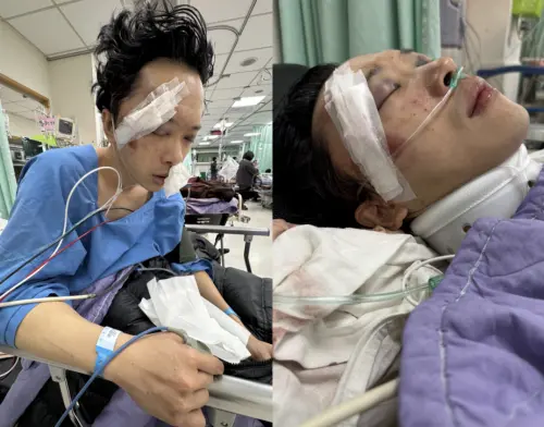 ▲蘇男拍攝時從高處墜落，傷勢相當慘烈。（圖／Rena提供）