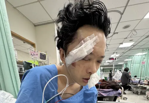 ▲《豆腐媽媽》臨演蘇德揚墜樓，造成顱內出血、顏面多處複雜性骨折。（圖／Rena提供）