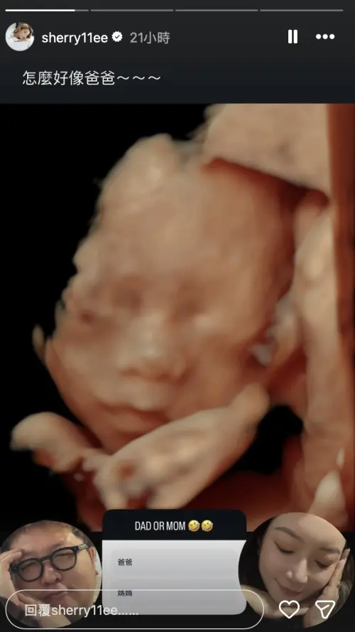 ▲納豆女兒4D超音波照，被笑稱長相神似老公納豆。（圖／翻攝依依IG@sherry11ee）