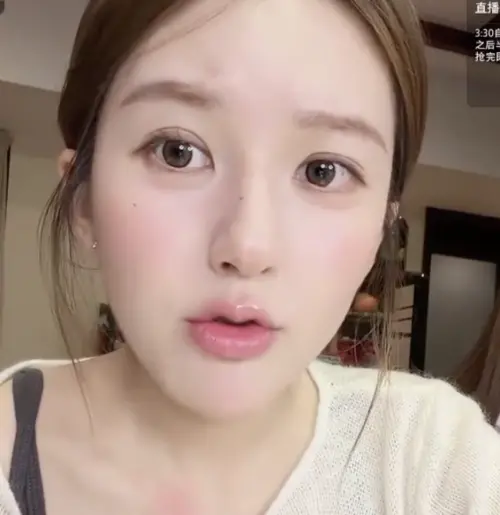 ▲趙露思直播中硬吃蜂蜜，結果皮膚嚴重過敏。（圖／翻攝自微博）