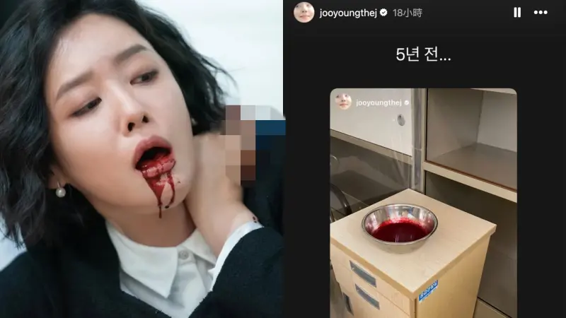 ▲《黑暗榮耀》車珠英長期出現反覆性流鼻血症狀，還公開5年前鼻血流滿整片馬路的畫面，驚悚程度嚇壞眾人。（圖／jooyoungthej）