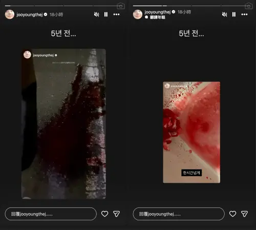 ▲車珠英5年前鼻血流不停，最近已經動手術，積極治療中。（圖／jooyoungthej）