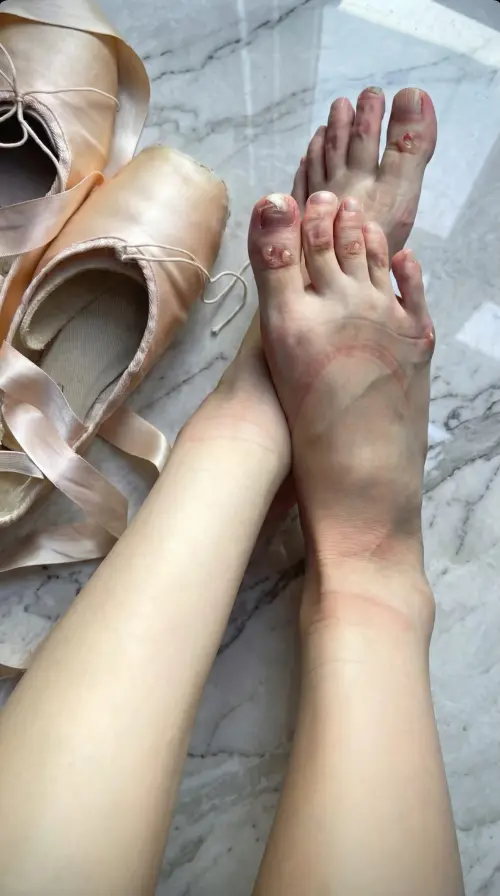 ▲李元玲脫下舞鞋腳趾全是水泡，她表示：「一切都值得。」（圖／李元玲Threads）