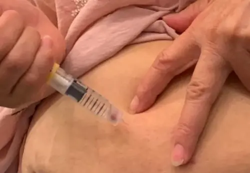 ▲名醫魏正宗教授與研究團隊發現，瘦瘦針不只減重，合併黃體素使用，子宮內膜癌風險降6成，已登上國際期刋。（圖／魏正宗提供）