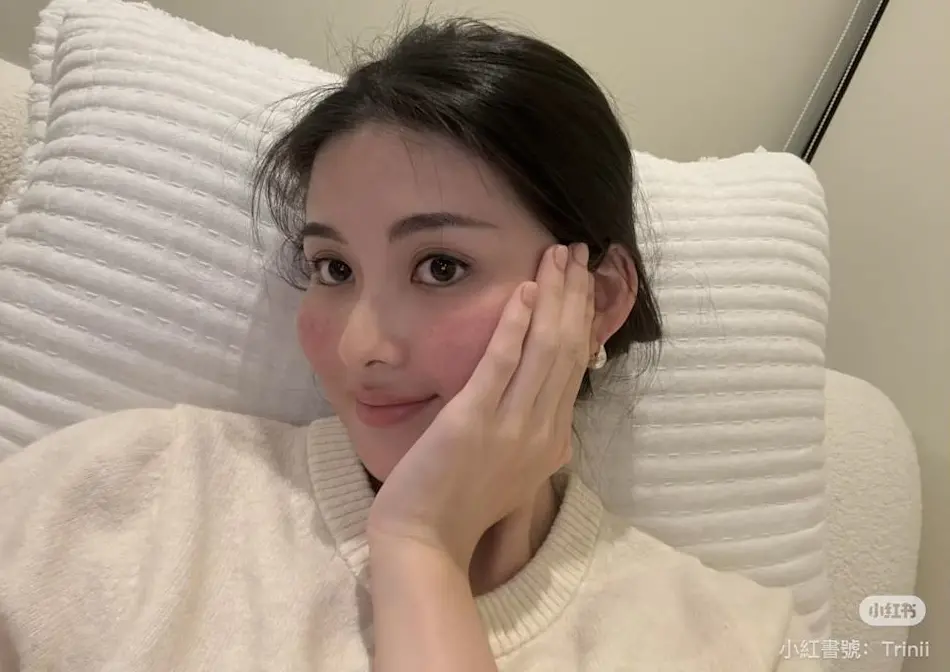 ▲孫芸芸愛女廖思惟（如圖）今（24）日遭爆未婚生子，網友也翻出她日前曬卸完妝照片，透露玫瑰斑狂發作，疑似就是生產後的近況。（圖／廖思惟小紅書）