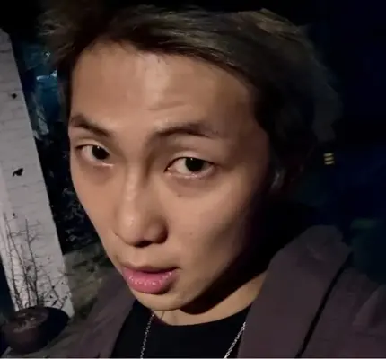 BTS RM韌帶受傷！明活動恐限制