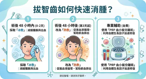 ▲拔智齒如何快速消腫？醫師建議掌握「先冰後熱」關鍵：術後48小時內先冰敷減緩出血，第3天起改為熱敷幫助淤血排出，亦可搭配PRP等專業輔助加速修復。（示意圖／Gemini生成／NOEWNEWS監製）
