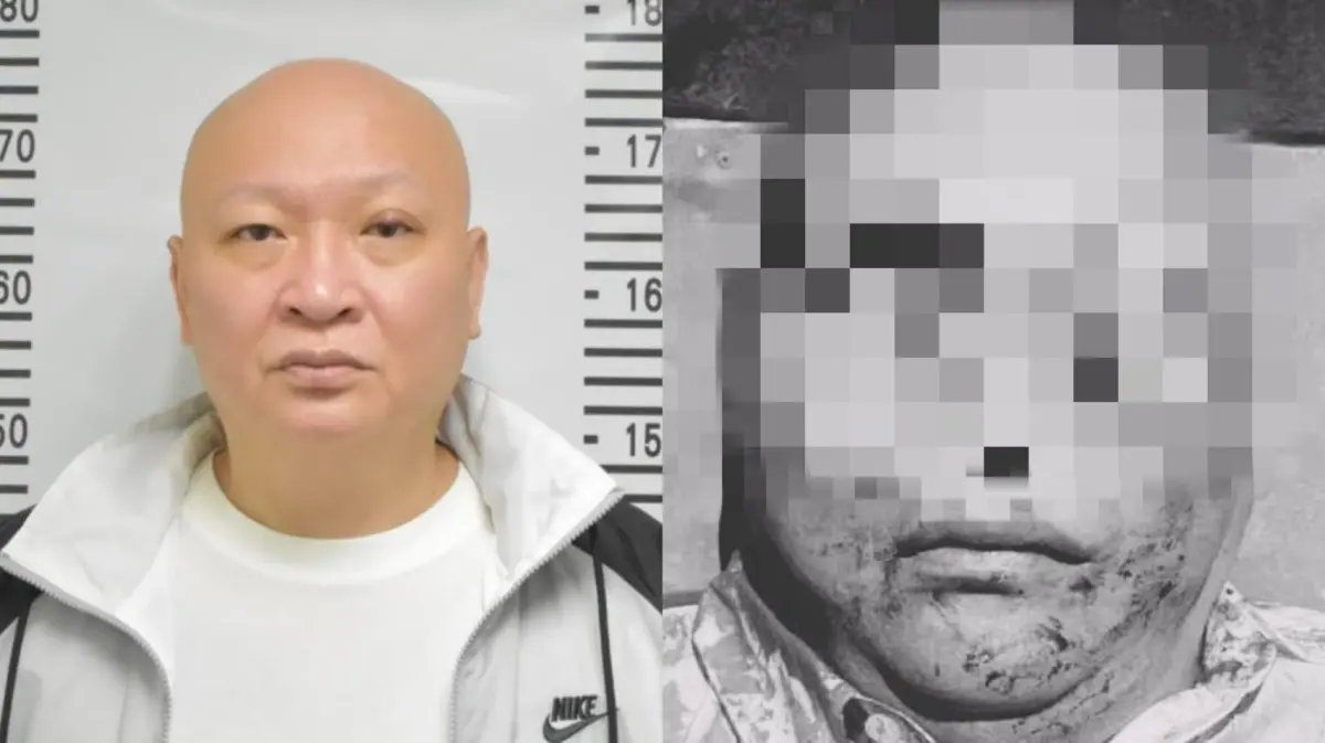 ▲網路上瘋傳一張林秉文遭槍殺後的死狀照，可見其滿臉鮮血、臉上還留一道長疤。（圖／翻攝畫面）