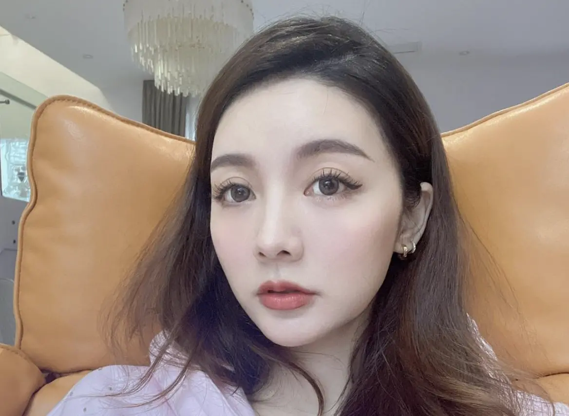 ▲吳亞馨（如圖）久未現身，近期在社群分享，孕期間罹患妊娠糖尿病，每天都要扎針驗血，直到生完小孩後，頭髮都禿了。（圖／翻攝自吳亞馨臉書）