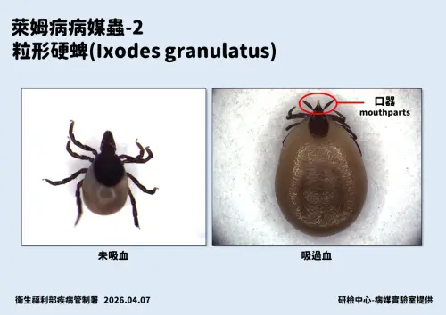 ▲萊姆病病原蟲。（圖／疾管署提供）