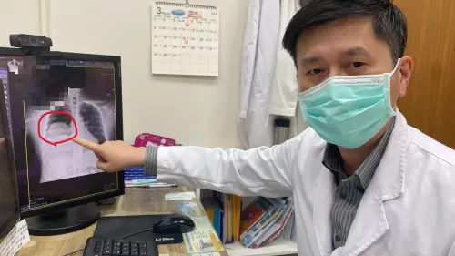 ▲醫師表示，有5%肺部單發性纖維瘤患者會合併低血糖症狀。（圖／員榮醫院提供）