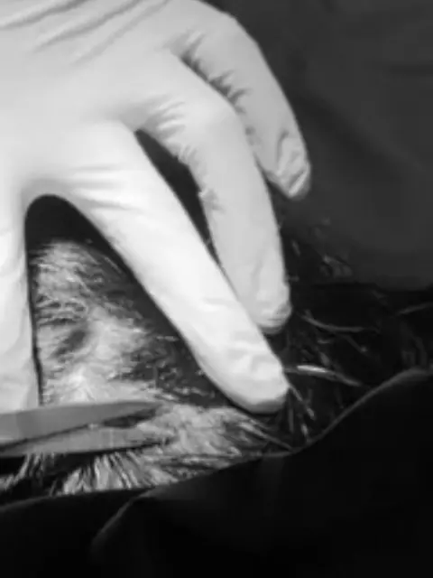 ▲丫頭在IG上曬出自己縫5針的動態，自嘲自己被「震撼教育」。（圖／翻攝自丫頭IG@ava112411）