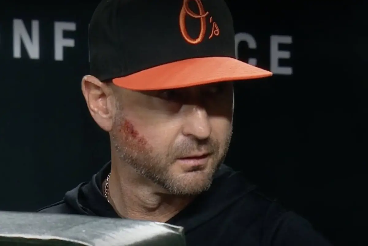 ▲巴爾的摩金鶯（Baltimore Orioles）總教練阿爾伯納茲（Craig Albernaz）遭自家打者擊出的界外平飛球直擊臉部，臉上還留下大紅印，畫面險象環生。（圖／取自MLB.com）