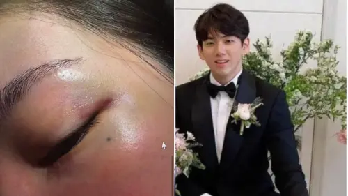 BLACKPINK Jisoo哥哥疑家暴老婆、硬上網紅拍裸照　求救紀錄公開