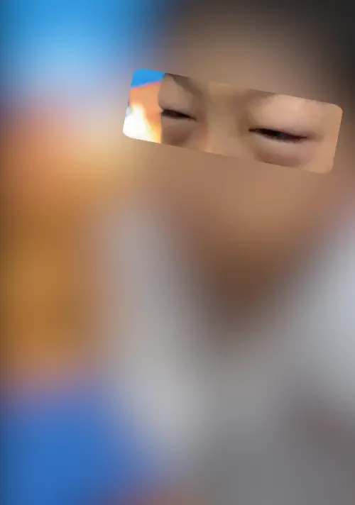 ▲眼睛因倒立過久浮腫。（圖／人本教育基金會提供）