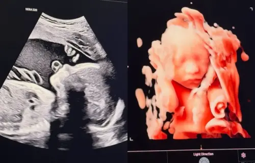 ▲宋承炫在IG出曬超音波照，親自宣布當爸好消息。（圖／宋承炫IG@soow456）