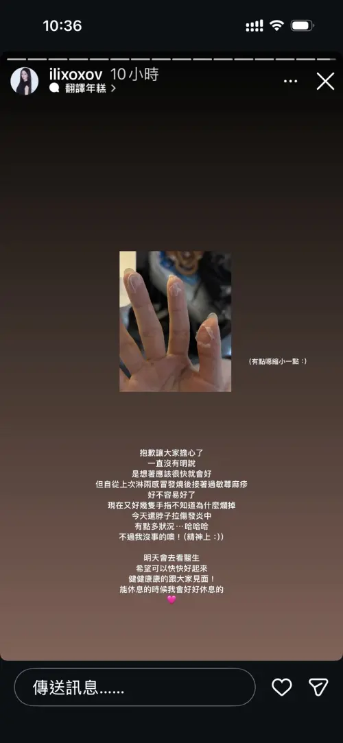 ▲一粒公開3根手指發白、脫皮的照片，坦言身體出狀況。（圖／ɪʟɪ 一粒IG@ilixoxov）