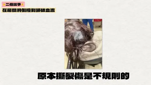 ▲二伯的傷口總共縫了9針。（圖／翻攝自蔡阿嘎YouTube）