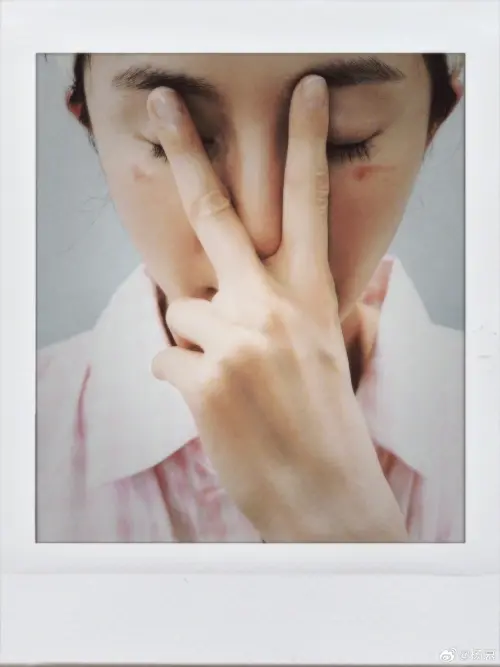 ▲楊冪親自曬出被蒸氣眼罩燙傷的傷口。（圖／微博@楊冪）