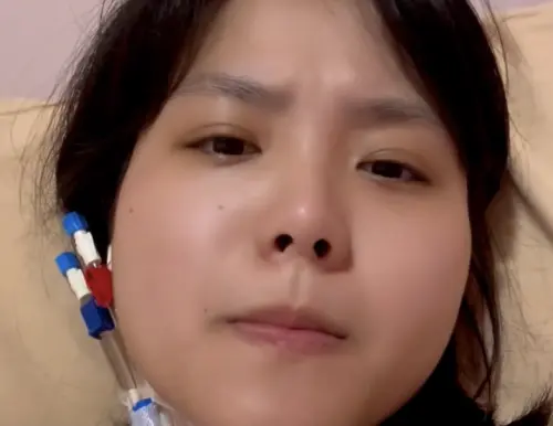 26歲山豬妹突住院裝人工血管！為捐骨髓前置超辛苦：痛到像被狗咬