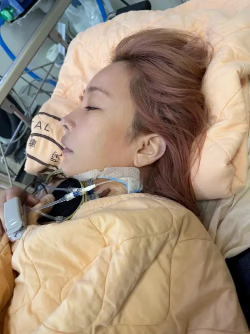 ▲經紀人PO出温嵐（如圖）躺在病床的照片，看起來仍十分憔悴，但若順利的話預計9月可以回到舞台上再與大家見面。（圖／温嵐臉書）