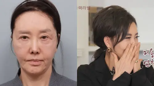 女星整張臉鬆到能拍打！狠做拉皮求醫生拉緊一點　61歲嫩成少女臉