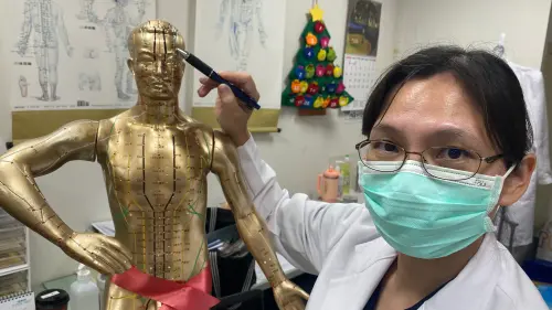 ▲醫師表示，透過個案眼睛四周穴位針灸下針，幫助病患的神經修復。（圖／記者張乃文攝）