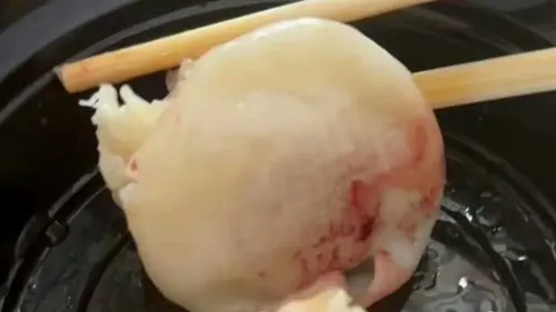 早餐吃到一半傻眼！燒賣底部驚見大片血跡　衝醫院急檢查