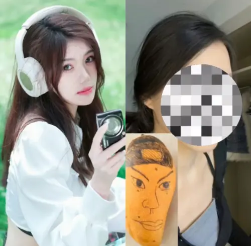24歲女做正顎手術　術後對鏡一看臉歪掉：我怎麼變朱元璋了？
