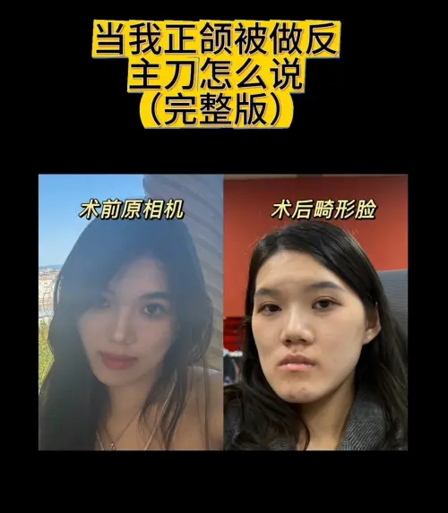 ▲術前好好的，術後像朱元璋（圖／截自抖音）