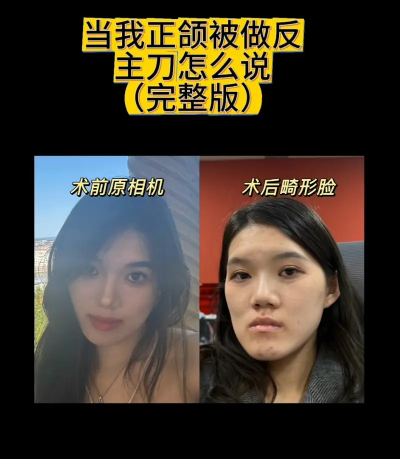 ▲術前好好的,術後像朱元璋(圖/截自抖音)