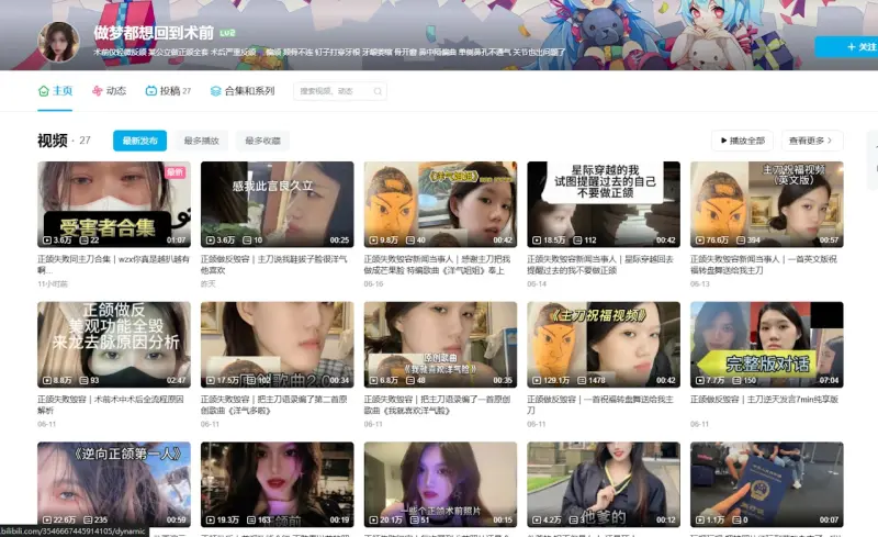 ▲術前好好的,術後像朱元璋(圖/截自抖音)