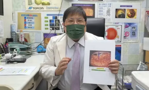 紅頭平甲蛛從天而降　 22歲櫃姐「衛生紙包屍」急求救眼科