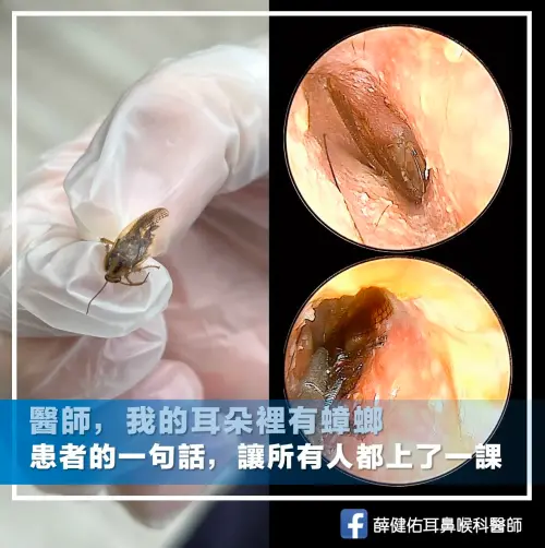 ▲耳鼻喉科醫師薛健佑表示，思覺失調症可能影響知覺與判斷，但不代表所有主訴都是錯的，醫療人員應客觀檢查每一項症狀，避免因偏見延誤真正需要治療的疾病。（圖／「薛健佑 耳鼻喉科醫師」授權提供）