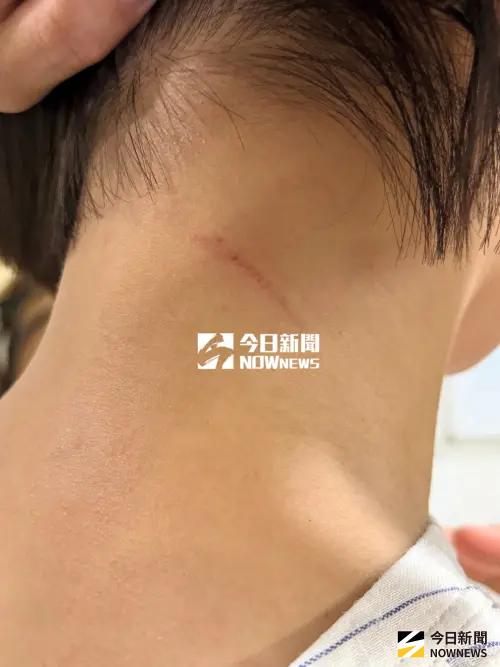 ▲台灣媽媽在菲律賓語言學校被韓國媽媽掐脖毆打。（圖／當事人提供）