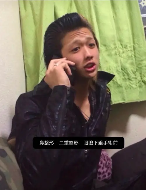 ▲《不良一族尋愛記2》阿一整型前照片曝光，畫面標註他曾接受鼻整型、雙眼皮整型及眼瞼下垂手術。（圖／翻攝自X @motiva55）